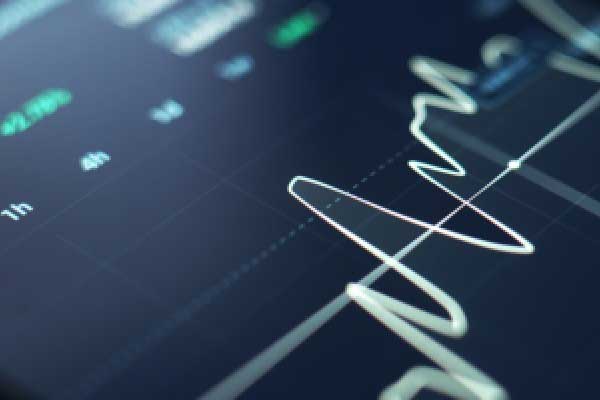 错失恐惧症 vs 泡沫焦虑：预示着2026年美国股市将出现更多波动